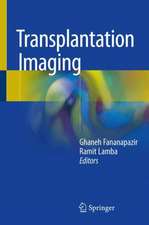 Transplantation Imaging