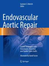 Endovascular Aortic Repair: Current Techniques with Fenestrated, Branched and Parallel Stent-Grafts