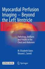 Myocardial Perfusion Imaging - Beyond the Left Ventricle: Pathology, Artifacts and Pitfalls in the Chest and Abdomen