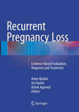 Recurrent Pregnancy Loss: Evidence-Based Evaluation, Diagnosis and Treatment