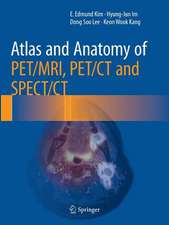 Atlas and Anatomy of PET/MRI, PET/CT and SPECT/CT