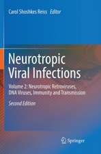 Neurotropic Viral Infections: Volume 2: Neurotropic Retroviruses, DNA Viruses, Immunity and Transmission