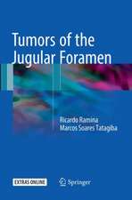 Tumors of the Jugular Foramen