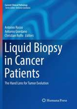 Liquid Biopsy in Cancer Patients: The Hand Lens for Tumor Evolution