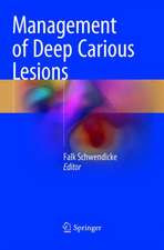 Management of Deep Carious Lesions