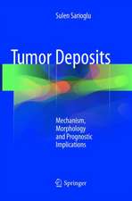 Tumor Deposits: Mechanism, Morphology and Prognostic Implications