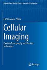 Cellular Imaging: Electron Tomography and Related Techniques