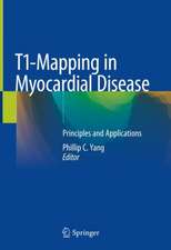 T1-Mapping in Myocardial Disease: Principles and Applications