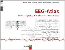 EEG-Atlas