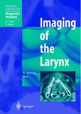 Imaging of the Larynx