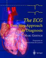 The ECG: A Two-Step Approach to Diagnosis