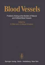 Blood Vessels: Problems Arising at the Borders of Natural and Artificial Blood Vessels