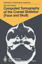 Computed Tomography of the Cranial Skeleton (Face and Skull): 58 Radiological Exercises for Students and Practitioners