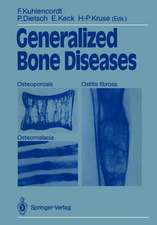 Generalized Bone Diseases: Osteoporosis Osteomalacia Ostitis fibrosa