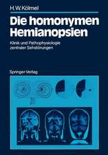 Die homonymen Hemianopsien: Klinik und Pathophysiologie zentraler Sehstörungen