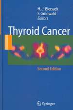 Thyroid Cancer