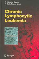 Chronic Lymphocytic Leukemia