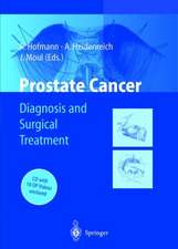 Prostate Cancer