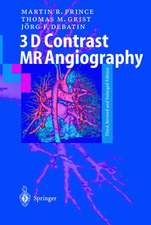 3D Contrast MR Angiography