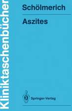 Aszites