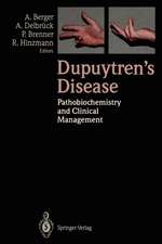 Dupuytren’s Disease: Pathobiochemistry and Clinical Management