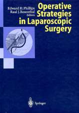 Operative Strategies in Laparoscopic Surgery