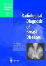 Radiological Diagnosis of Breast Diseases