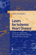 Lasers for Ischemic Heart Disease