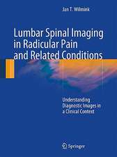 Lumbar Spinal Imaging in Radicular Pain and Related Conditions: Understanding Diagnostic Images in a Clinical Context