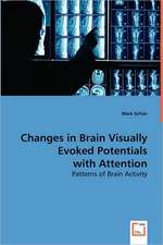 Changes in Brain Visually Evoked Potentials with Attention