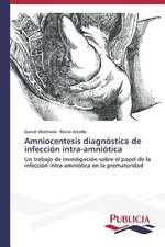 Amniocentesis Diagnostica de Infeccion Intra-Amniotica: Un Ilustrado En Tiempos de Oscuridad