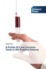 A Profile of Liver Function Tests in HIV Positive Patients