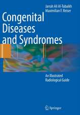 Congenital Diseases and Syndromes: An Illustrated Radiological Guide