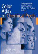 Color Atlas of Chemical Peels