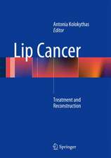 Lip Cancer: Treatment and Reconstruction