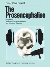 The Prosencephalies: Morphology, Neuroradiological Appearances and Differential Diagnosis