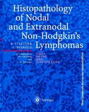 Histopathology of Nodal and Extranodal Non-Hodgkin’s Lymphomas