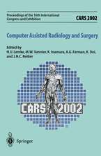 CARS 2002 Computer Assisted Radiology and Surgery: Proceedings of the 16th International Congress and Exhibition Paris, June 26–29,2002