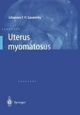 Uterus myomatosus