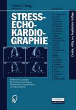 Streß-echokardiographie: Praktischer Leitfaden für die Klinik und Praxis, Rehabilitation, Sozialmedizin und Sportmedizin