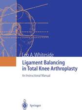 Ligament Balancing in Total Knee Arthroplasty: An Instructional Manual