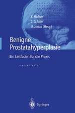 Benigne Prostatahyperplasie: Leitfaden für die Praxis