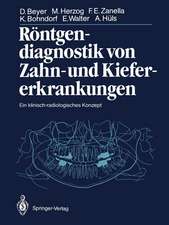 Röntgendiagnostik von Zahn- und Kiefererkrankungen