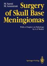 Surgery of Skull Base Meningiomas