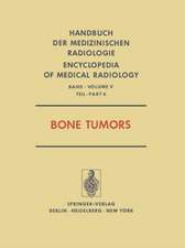 Bone Tumors