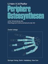 Periphere Osteosynthesen: unter Verwendung des Kleinfragment-Instrumentariums der AO