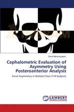 Cephalometric Evaluation of Asymmetry Using Posteroanterior Analysis