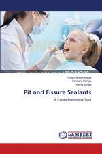 Pit and Fissure Sealants