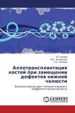 Allotransplantatsiya kostey pri zameshchenii defektov nizhney chelyusti