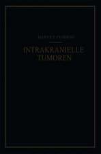 Intrakranielle Tumoren: Bericht über 2000 Bestätigte Fälle mit der Zugehörigen Mortalitätsstatistik